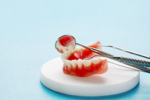 失った歯の補い方の選択肢と利点欠点