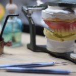 手術の際には入院が必要ですか？