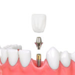 メンテナンスは必要ですか？頻度はどのくらいですか？