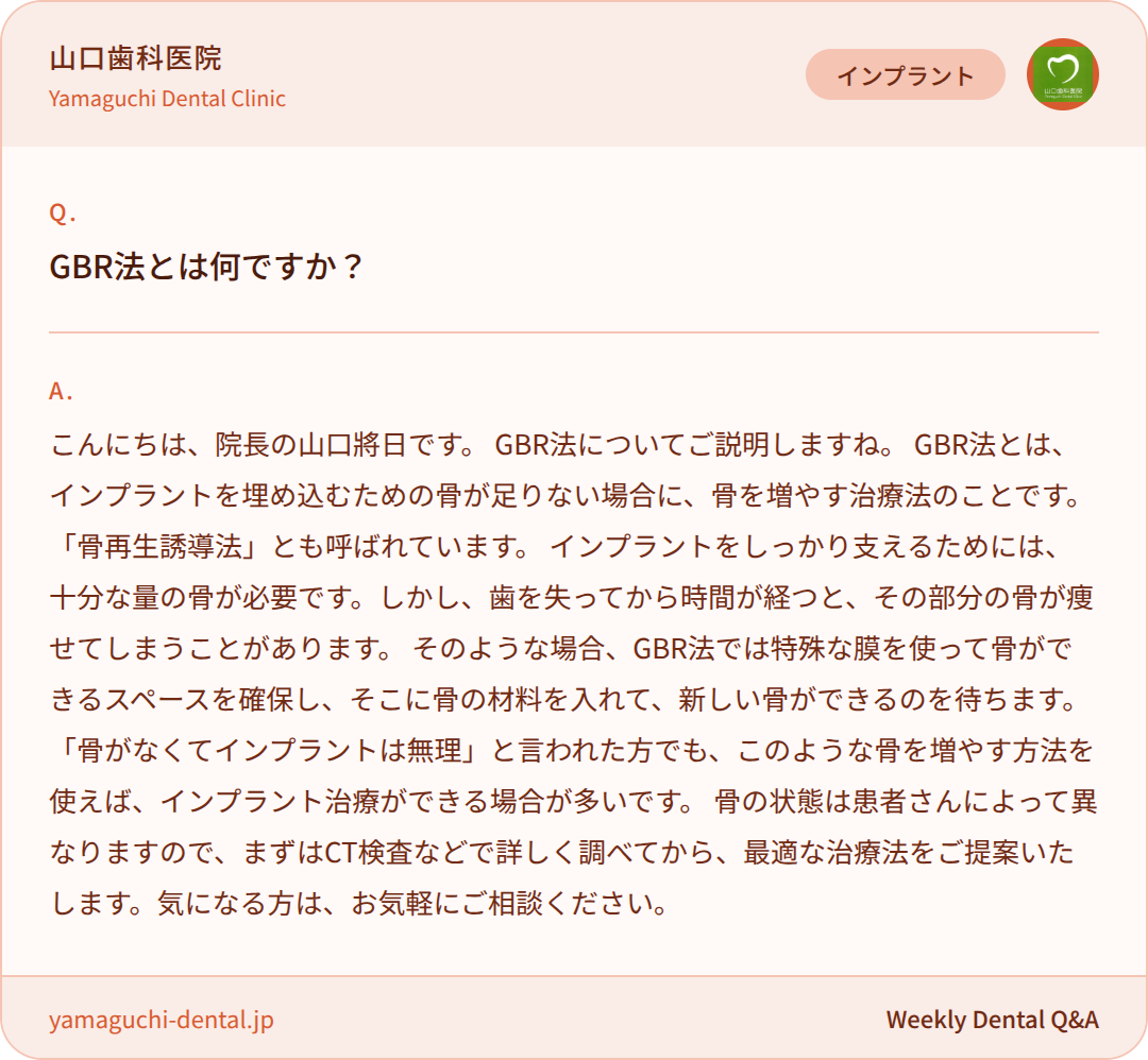 GBR法とは何ですか？