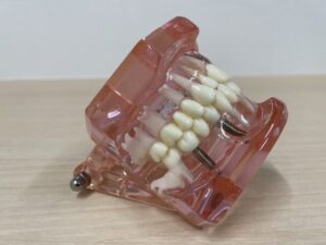 骨造成手術とは何ですか？