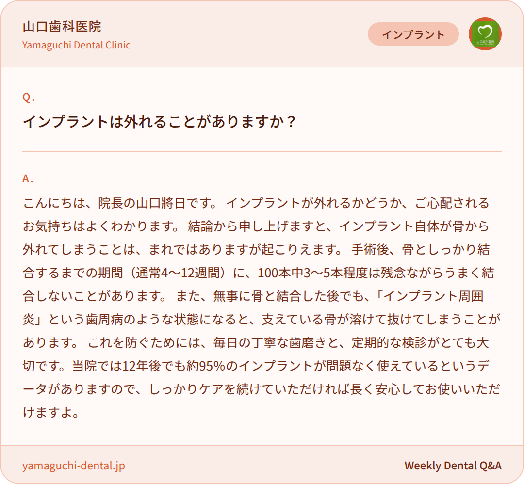 インプラントは外れることがありますか？