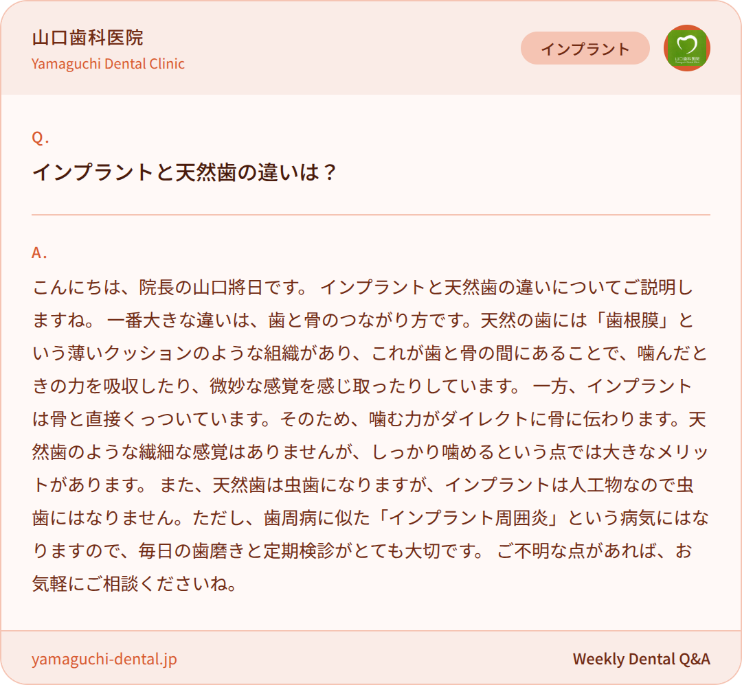 インプラントと天然歯の違いは？