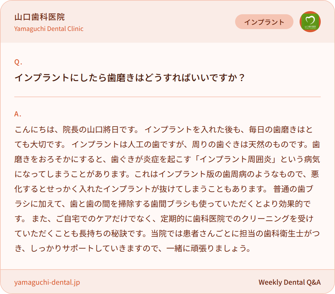 インプラントにしたら歯磨きはどうすればいいですか? インプラントにしたら歯磨きはどうすればいいですか?