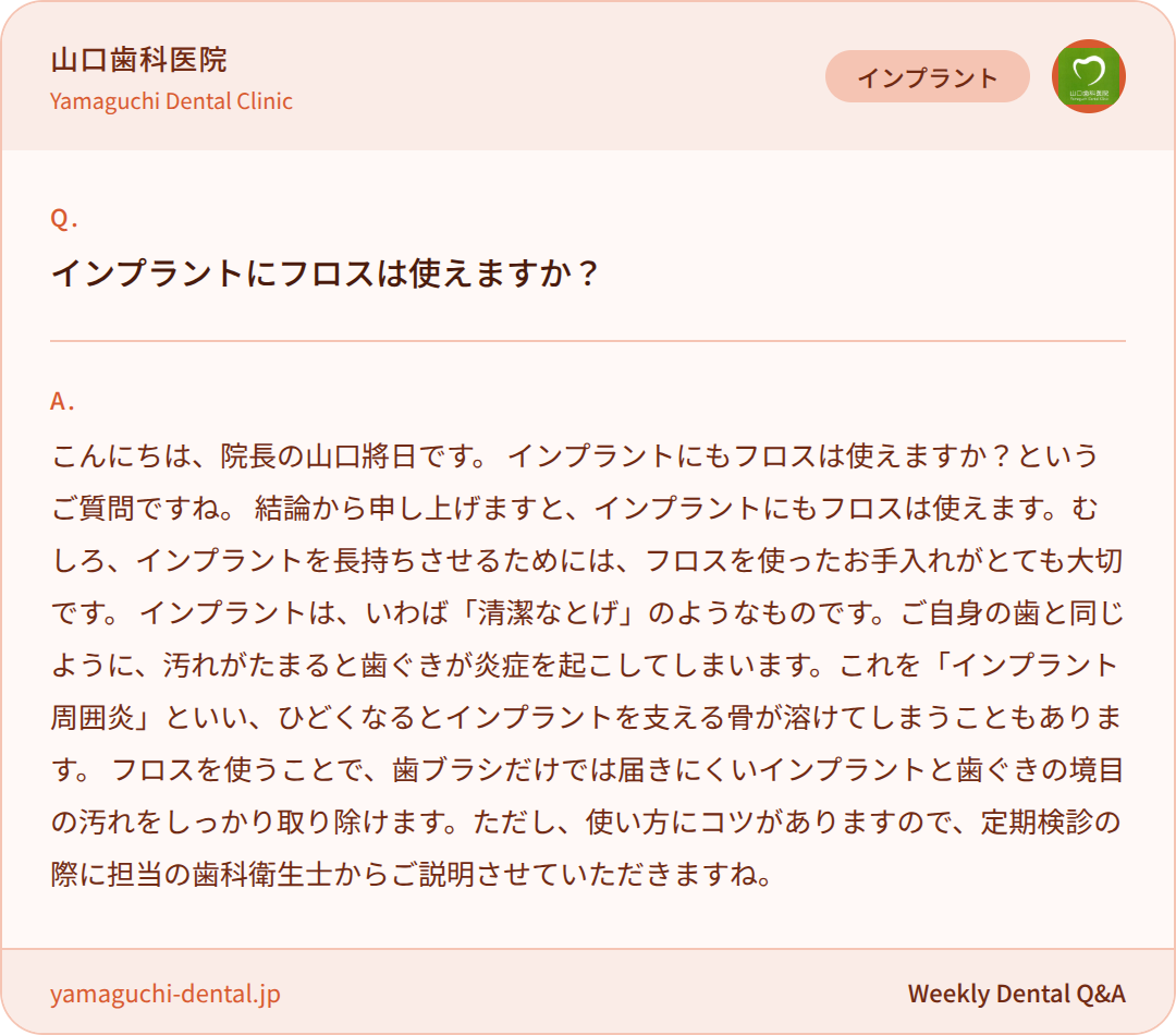 インプラントにフロスは使えますか? インプラントにフロスは使えますか?